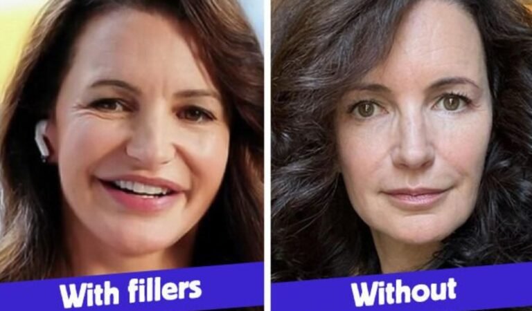 At 59, Kristin Davis Got Her Fillers Removed – And Everyone’s Stunned by Her Look At 59, Kristin Davis Got Her Fillers Removed – And Everyone’s Stunned by Her Look