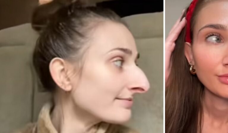 She Revealed Her Plastic Surgery Results And Everyone’s Jaw Dropped She Revealed Her Plastic Surgery Results And Everyone’s Jaw Dropped
